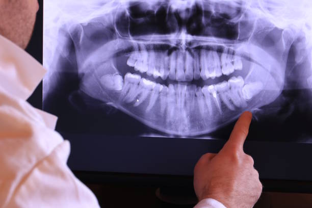 Best Pediatric Emergency Dentist in Wallace, NC