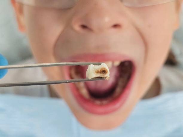 Best After-Hours Emergency Dentist in Wallace, NC